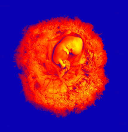 baby and placenta in red