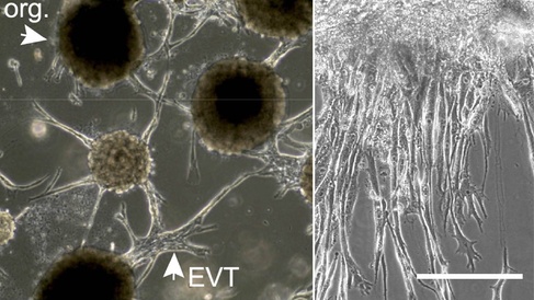 Trophoblast organoids with EVT differentiation