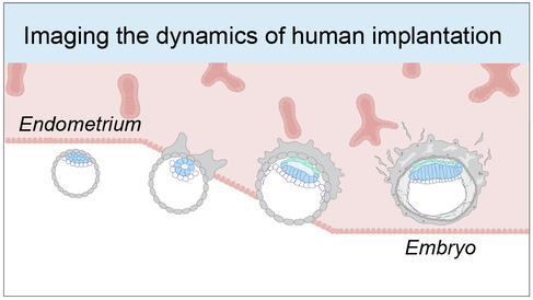 Imaging the dynamics of human implantation schematic