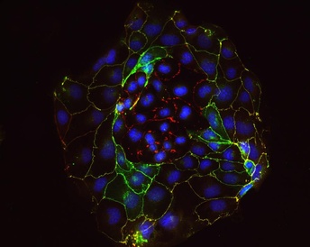 Image provided by Dr. Aleksandra Tsolova & Dr. Myriam Hemberger