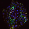Image provided by Dr. Aleksandra Tsolova & Dr. Myriam Hemberger