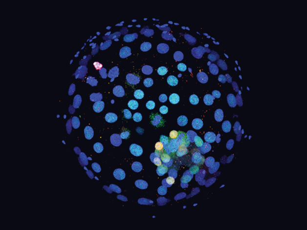 Human blastocyst stained for DNA