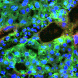 Image showing the signalling cells (in green) of the mouse placenta that are key for remote controlling the metabolism of the mother to support nutrient supply and growth of the fetus. Credit_ Sferruzzi