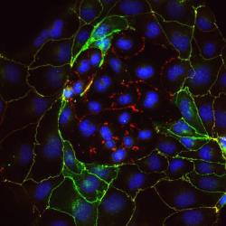Image provided by Dr. Aleksandra Tsolova & Dr. Myriam Hemberger
