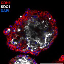 Ectopic expression of DNMT3L in human trophoblast stem cells restores features of the placental methylome