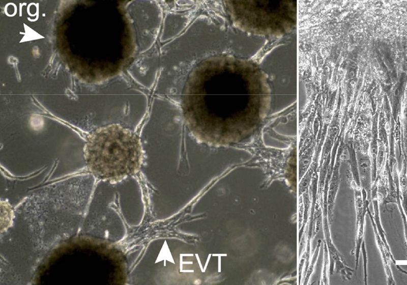 Trophoblast organoids with EVT differentiation