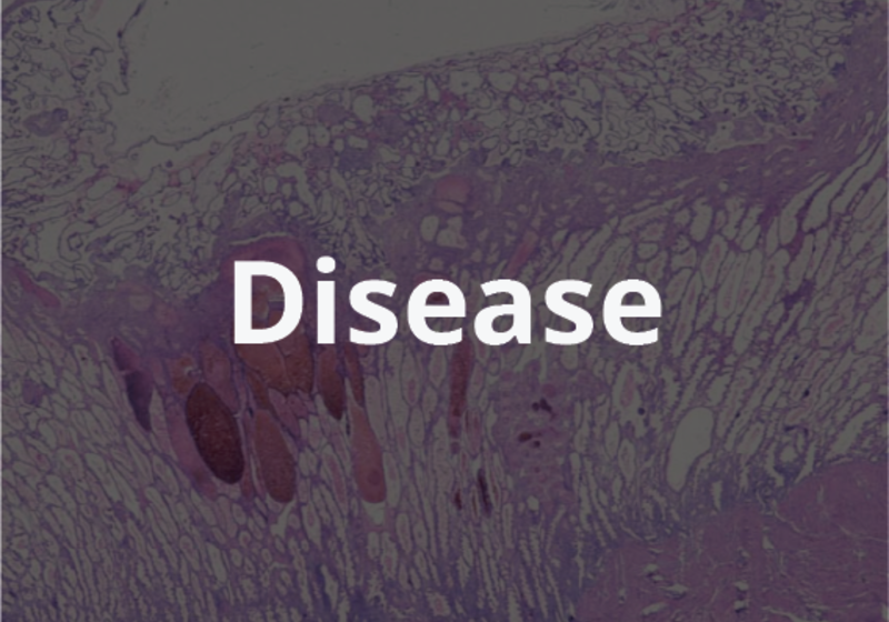 Disease