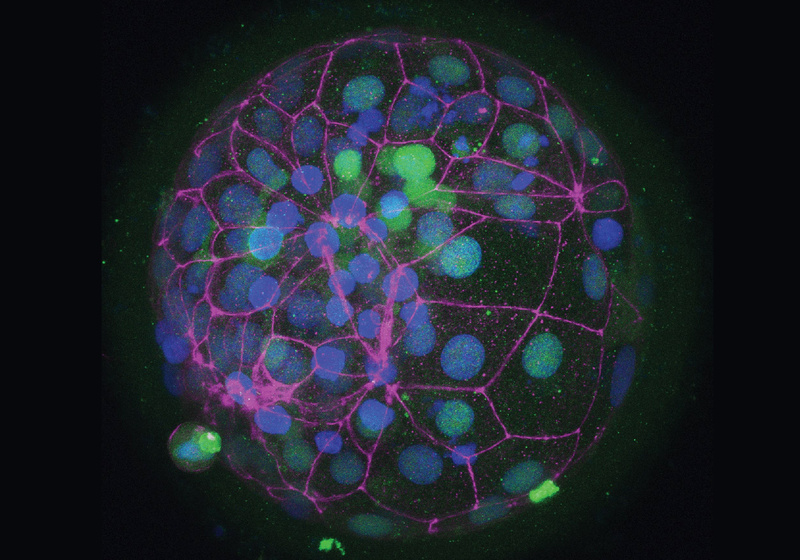 ZO-1 and OCT4 staining of a human blastocyst 