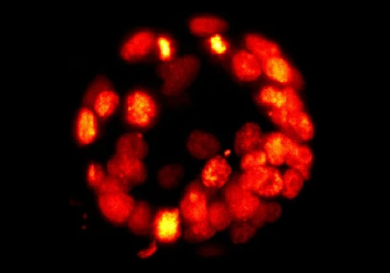 Human blastocyst stained for DNA
