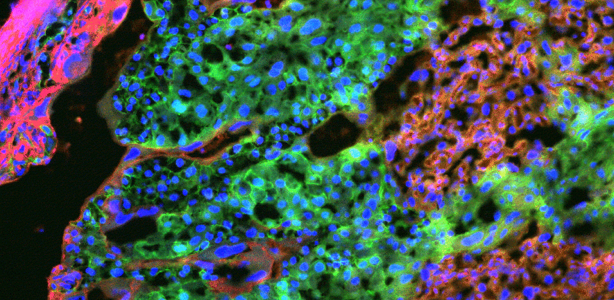 Image showing the signalling cells (in green) of the mouse placenta that are key for remote controlling the metabolism of the mother to support nutrient supply and growth of the fetus. Credit_ Sferruzzi
