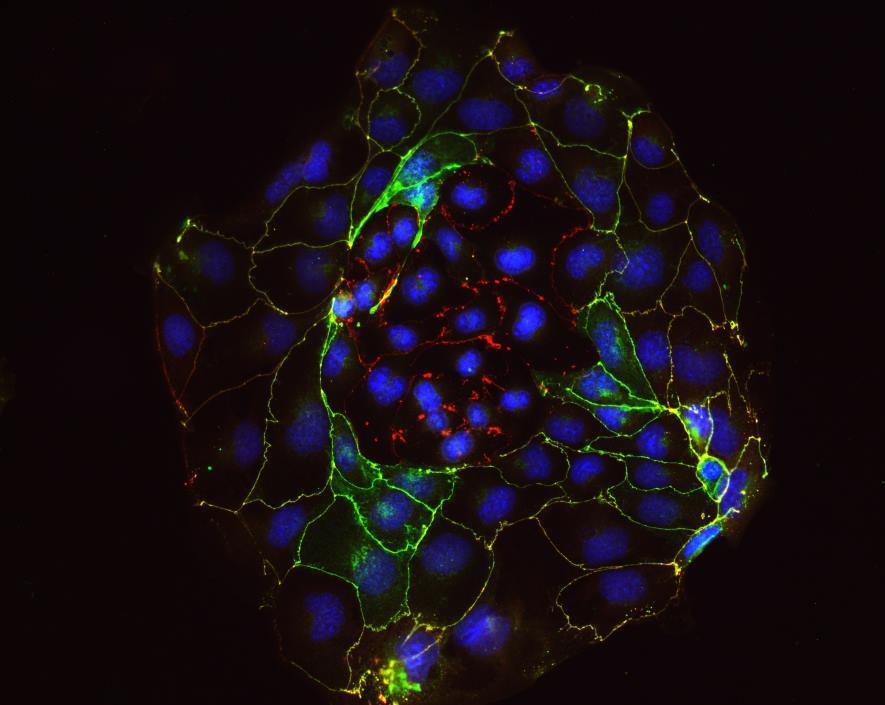 Image provided by Dr. Aleksandra Tsolova & Dr. Myriam Hemberger Image provided by Dr. Aleksandra Tsolova & Dr. Myriam Hemberger