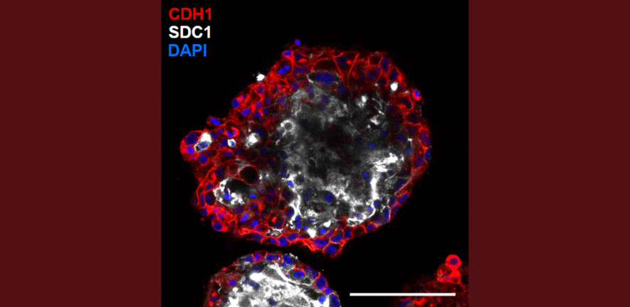 Ectopic expression of DNMT3L in human trophoblast stem cells restores features of the placental methylome Ectopic expression of DNMT3L in human trophoblast stem cells restores features of the placental methylome