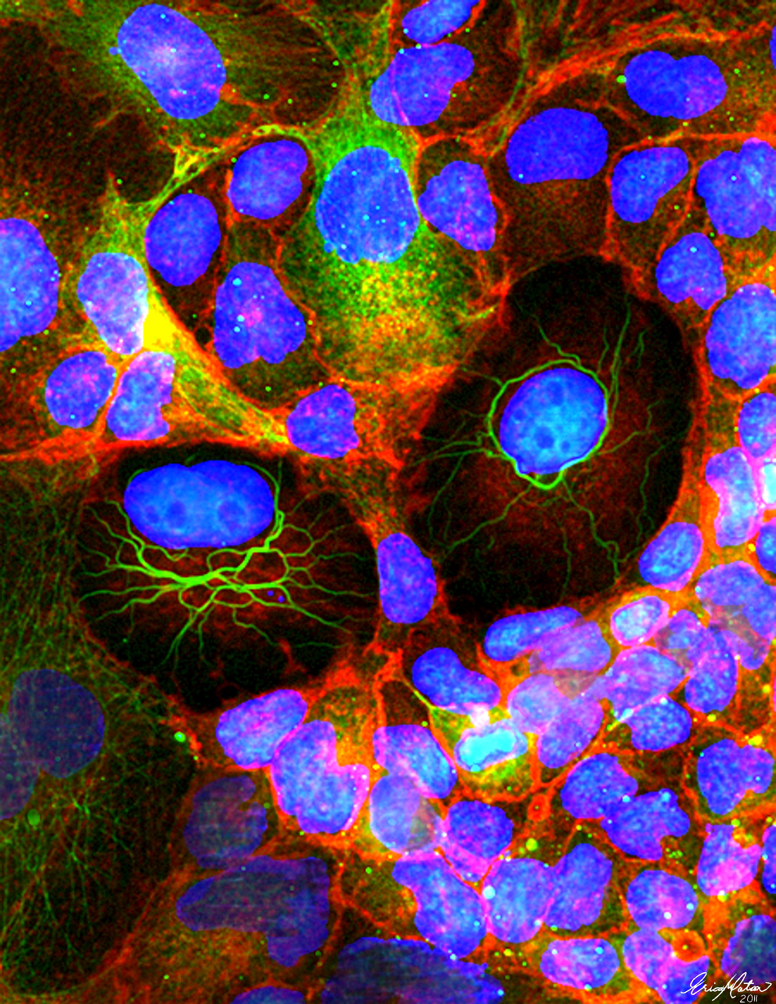 Trophoblast cells (by kind permission of Dr Erica Watson)